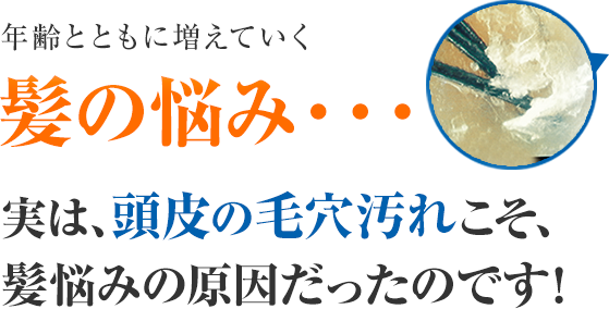 年齢とともに増えていく髪の悩み・・・ 実は、頭皮の毛穴汚れこそ、髪悩みの原因だったのです！