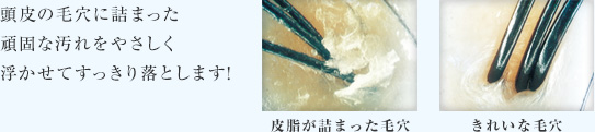 頭皮の毛穴に
                                    詰まった頑固な汚れをやさしく浮かせてすっきり落とします！ 皮脂が詰まった毛穴 きれいな毛穴